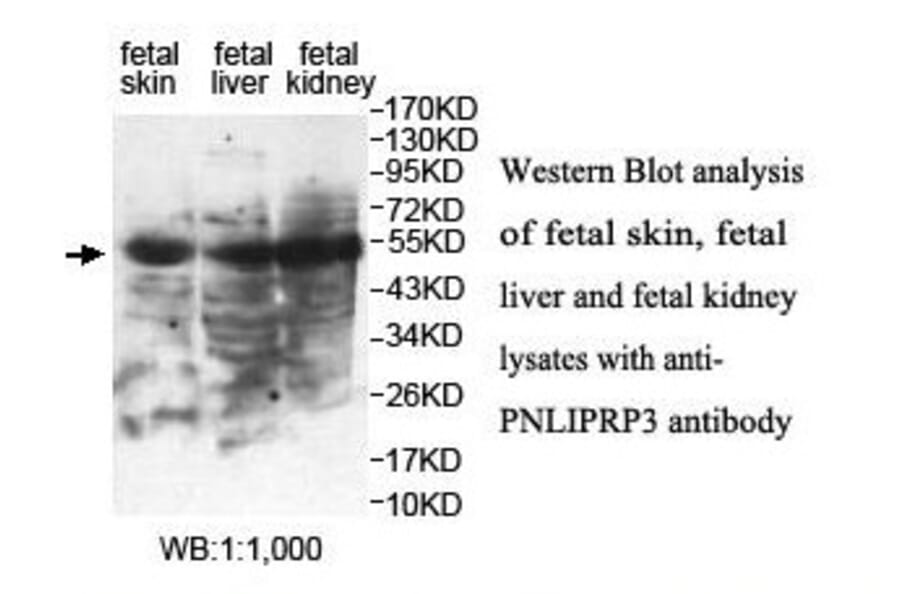 PNLIPRP3 Antibody from Signalway Antibody (39843) - Antibodies.com