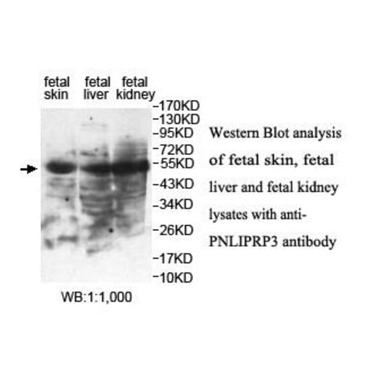 PNLIPRP3 Antibody from Signalway Antibody (39843) - Antibodies.com