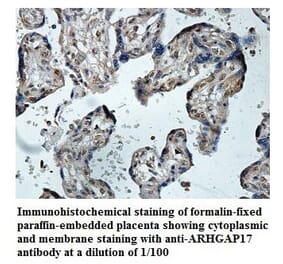 ARHGAP17 Antibody from Signalway Antibody (39847) - Antibodies.com