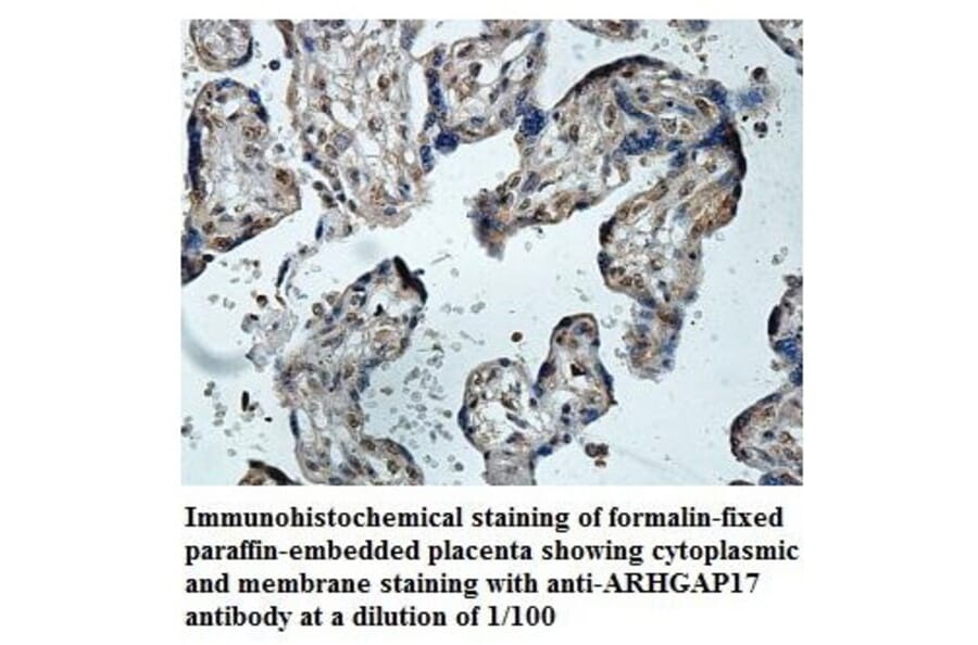 ARHGAP17 Antibody from Signalway Antibody (39847) - Antibodies.com