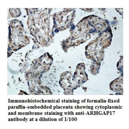 ARHGAP17 Antibody from Signalway Antibody (39847) - Antibodies.com