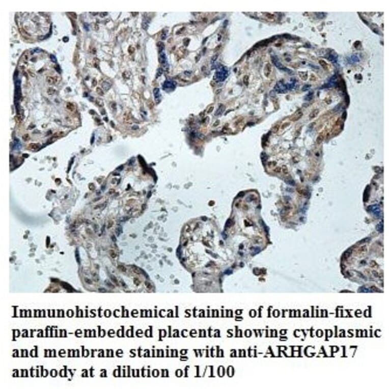 ARHGAP17 Antibody from Signalway Antibody (39847) - Antibodies.com