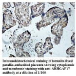 ARHGAP17 Antibody from Signalway Antibody (39847) - Antibodies.com
