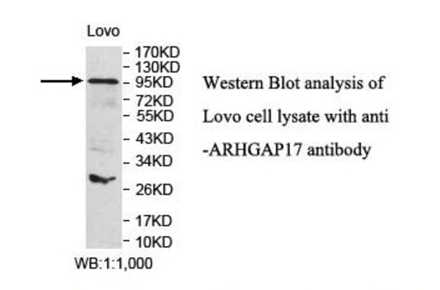 ARHGAP17 Antibody from Signalway Antibody (39847) - Antibodies.com