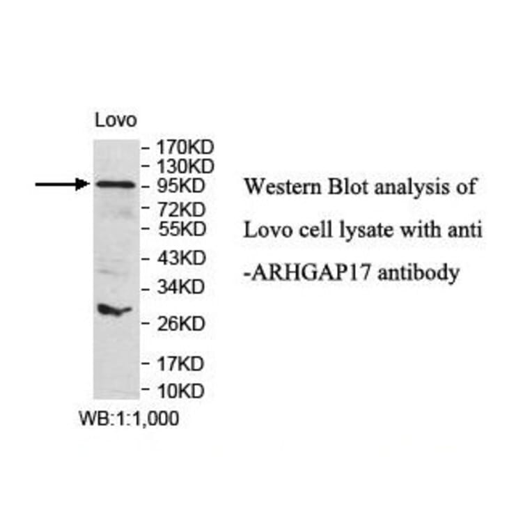 ARHGAP17 Antibody from Signalway Antibody (39847) - Antibodies.com