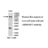 ARHGAP17 Antibody from Signalway Antibody (39847) - Antibodies.com