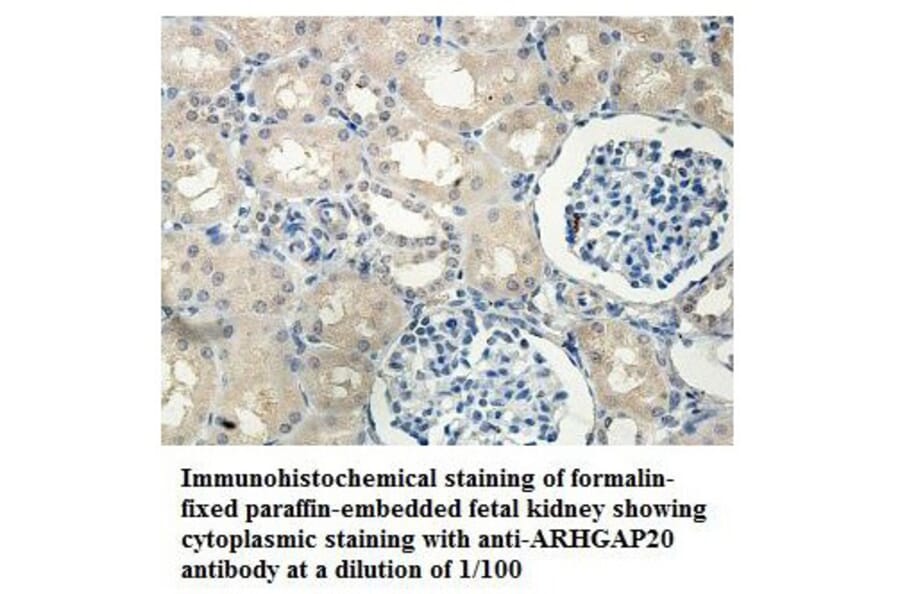 ARHGAP20 Antibody from Signalway Antibody (39848) - Antibodies.com
