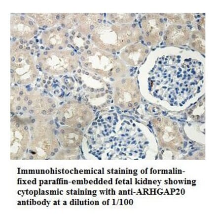 ARHGAP20 Antibody from Signalway Antibody (39848) - Antibodies.com