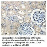 ARHGAP20 Antibody from Signalway Antibody (39848) - Antibodies.com