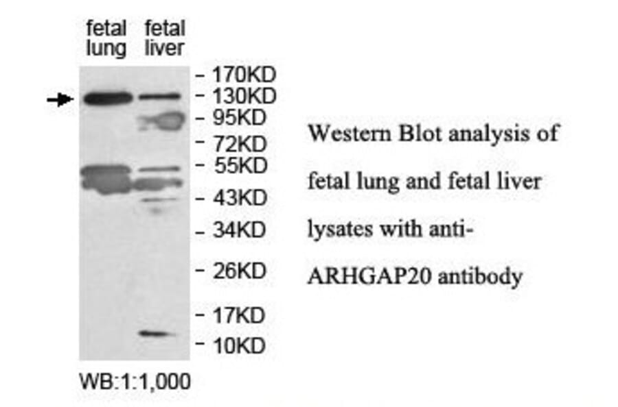 ARHGAP20 Antibody from Signalway Antibody (39848) - Antibodies.com