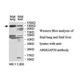 ARHGAP20 Antibody from Signalway Antibody (39848) - Antibodies.com