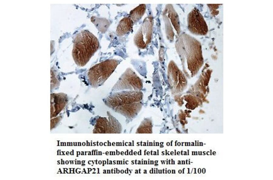ARHGAP21 Antibody from Signalway Antibody (39849) - Antibodies.com