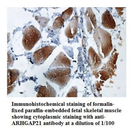 ARHGAP21 Antibody from Signalway Antibody (39849) - Antibodies.com