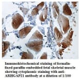 ARHGAP21 Antibody from Signalway Antibody (39849) - Antibodies.com