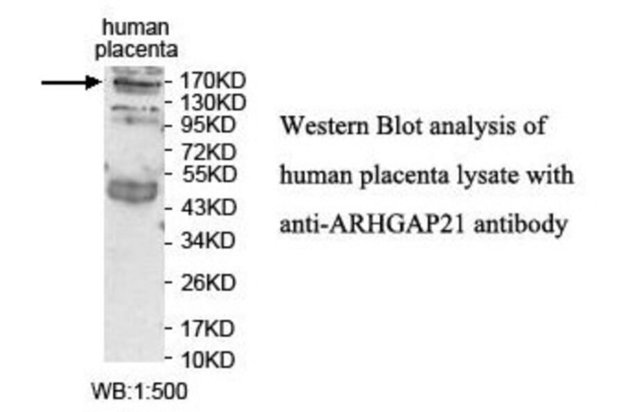 ARHGAP21 Antibody from Signalway Antibody (39849) - Antibodies.com