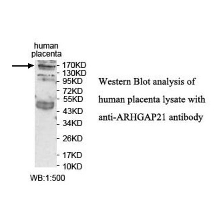 ARHGAP21 Antibody from Signalway Antibody (39849) - Antibodies.com
