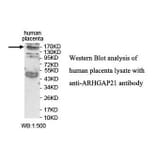 ARHGAP21 Antibody from Signalway Antibody (39849) - Antibodies.com