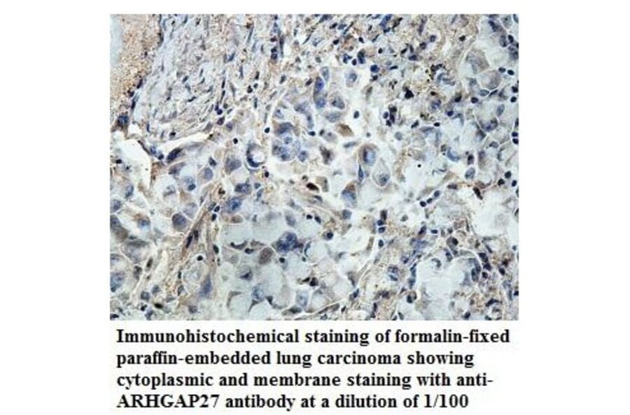 ARHGAP27 Antibody from Signalway Antibody (39850) - Antibodies.com