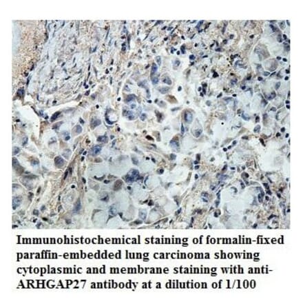ARHGAP27 Antibody from Signalway Antibody (39850) - Antibodies.com