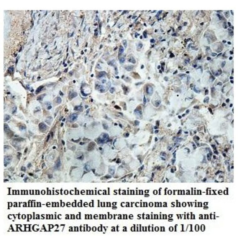 ARHGAP27 Antibody from Signalway Antibody (39850) - Antibodies.com