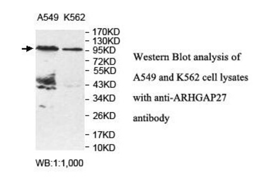ARHGAP27 Antibody from Signalway Antibody (39850) - Antibodies.com