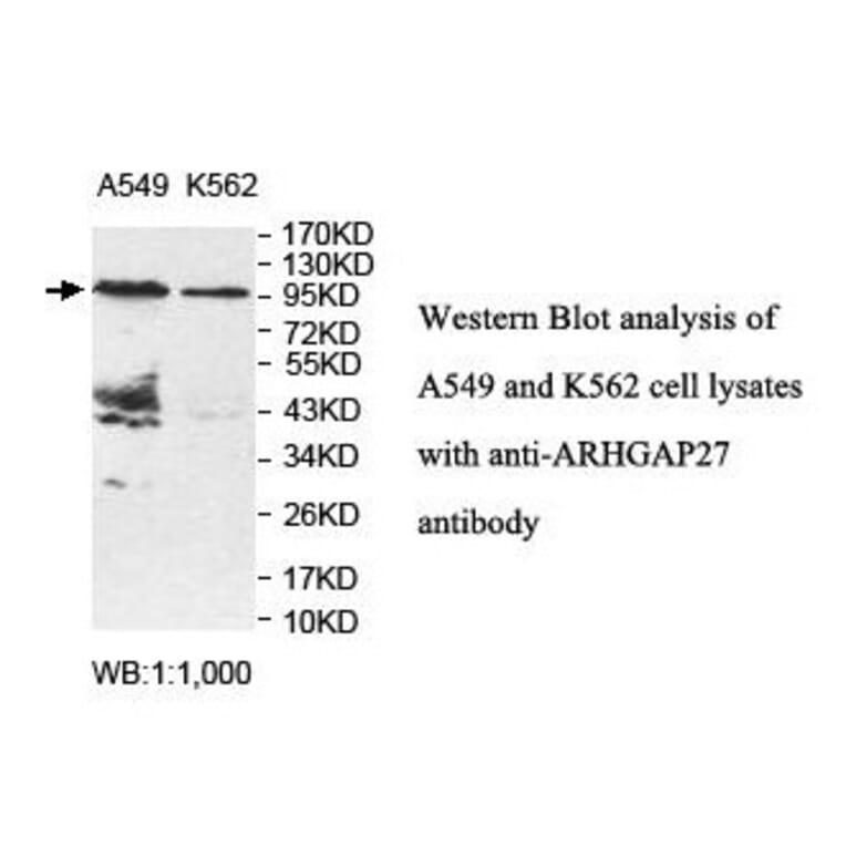 ARHGAP27 Antibody from Signalway Antibody (39850) - Antibodies.com