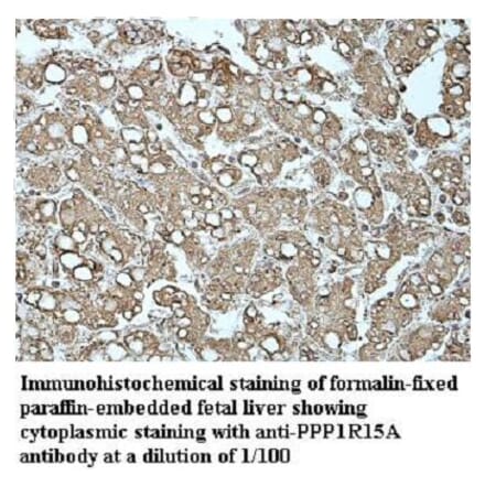 PPP1R15A Antibody from Signalway Antibody (39948) - Antibodies.com