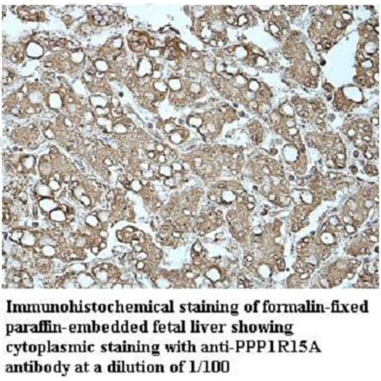 PPP1R15A Antibody from Signalway Antibody (39948) - Antibodies.com