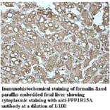 PPP1R15A Antibody from Signalway Antibody (39948) - Antibodies.com
