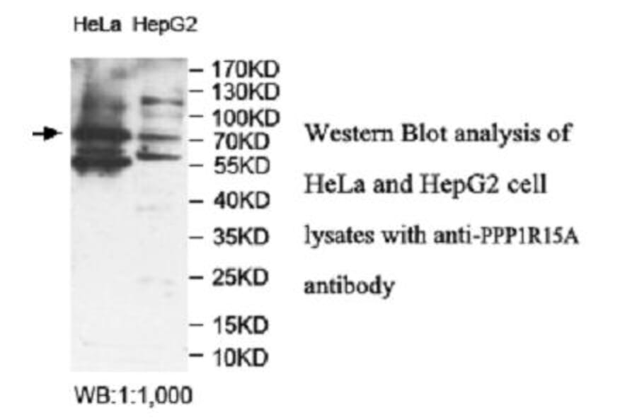 PPP1R15A Antibody from Signalway Antibody (39948) - Antibodies.com