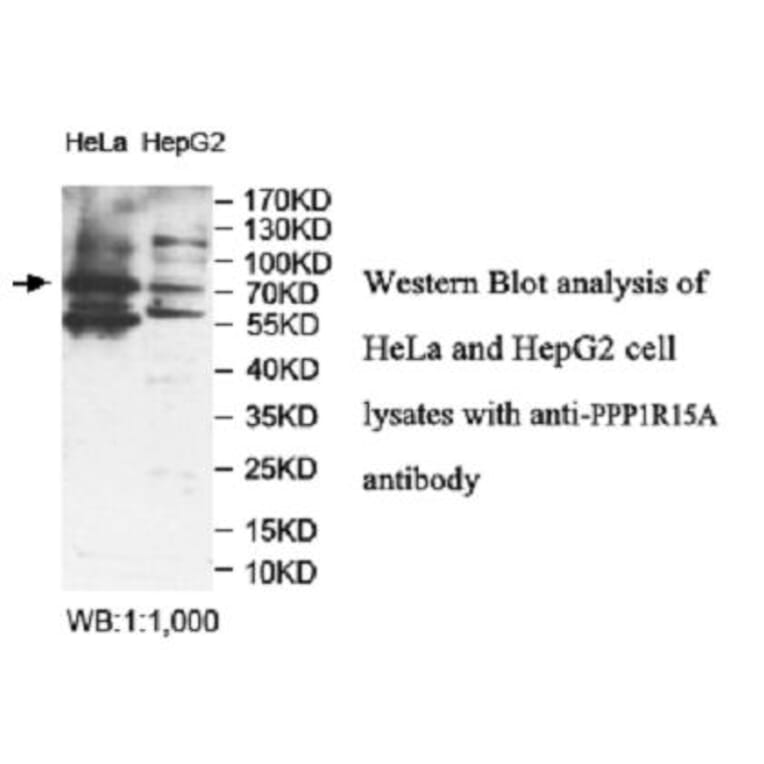 PPP1R15A Antibody from Signalway Antibody (39948) - Antibodies.com