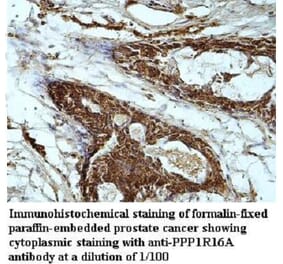 PPP1R16A Antibody from Signalway Antibody (39949) - Antibodies.com