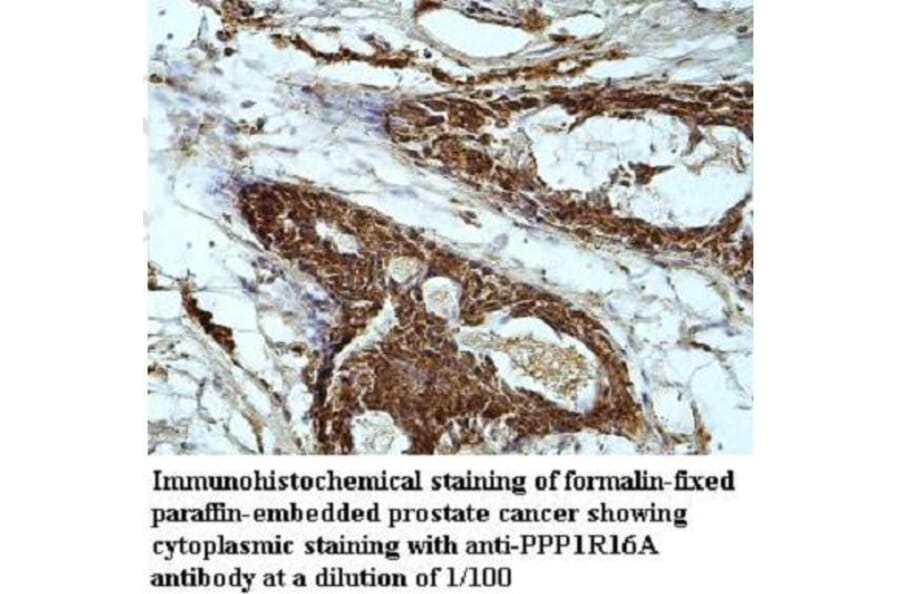 PPP1R16A Antibody from Signalway Antibody (39949) - Antibodies.com