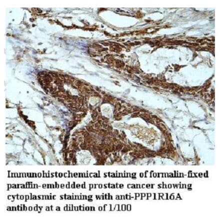 PPP1R16A Antibody from Signalway Antibody (39949) - Antibodies.com