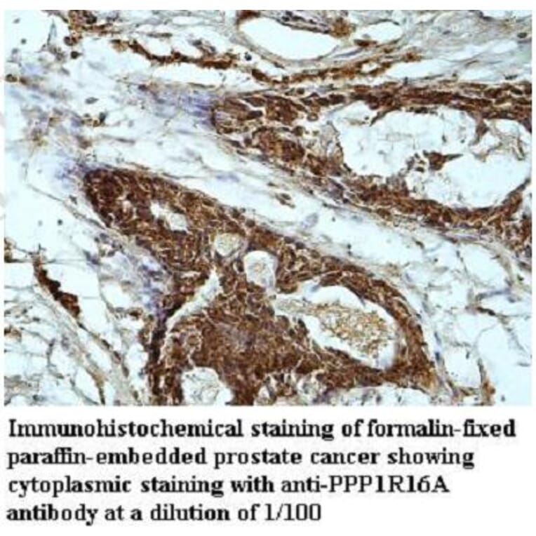 PPP1R16A Antibody from Signalway Antibody (39949) - Antibodies.com