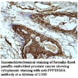 PPP1R16A Antibody from Signalway Antibody (39949) - Antibodies.com