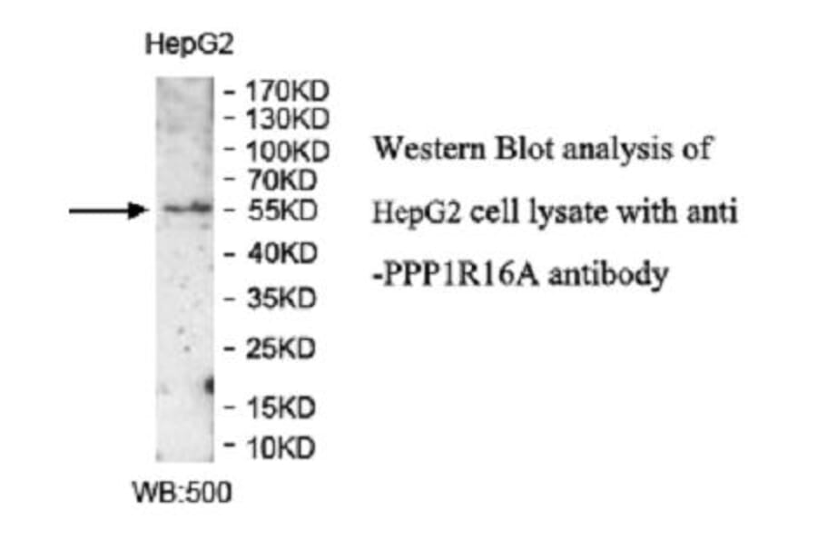 PPP1R16A Antibody from Signalway Antibody (39949) - Antibodies.com