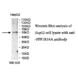 PPP1R16A Antibody from Signalway Antibody (39949) - Antibodies.com