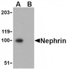 Western blot - Nephrin Antibody from Signalway Antibody (24104) - Antibodies.com