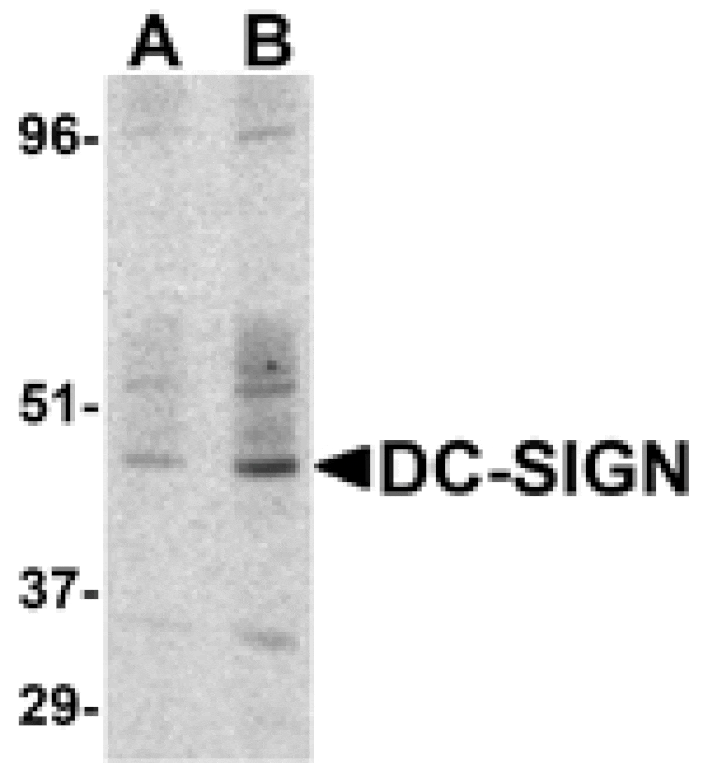 Western blot - DC-SIGN Antibody from Signalway Antibody (24125) - Antibodies.com