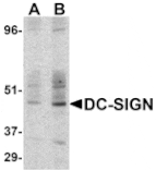 Western blot - DC-SIGN Antibody from Signalway Antibody (24125) - Antibodies.com