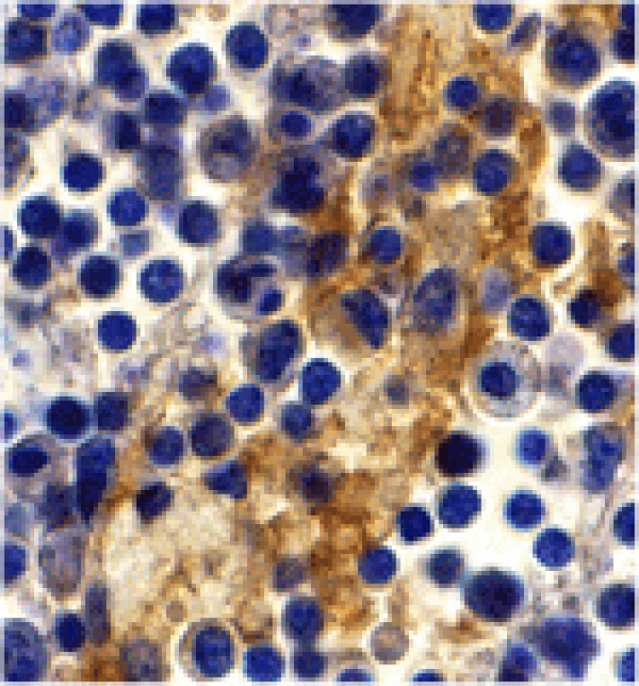 Immunohistochemistry - DC-SIGN Antibody from Signalway Antibody (24125) - Antibodies.com