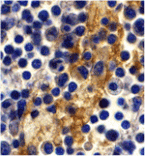 Immunohistochemistry - DC-SIGN Antibody from Signalway Antibody (24125) - Antibodies.com