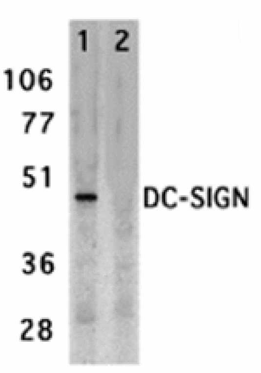 Western blot - DC-SIGN Antibody from Signalway Antibody (24126) - Antibodies.com