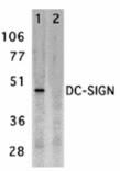 Western blot - DC-SIGN Antibody from Signalway Antibody (24126) - Antibodies.com