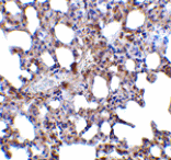 Immunohistochemistry - Blimp-1 Antibody from Signalway Antibody (24475) - Antibodies.com
