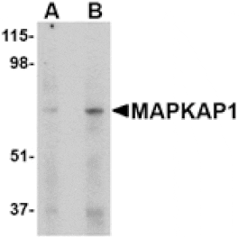 Western blot - MAPKAP1 Antibody from Signalway Antibody (24511) - Antibodies.com