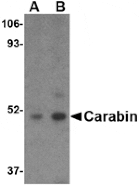 Western blot - Carabin Antibody from Signalway Antibody (24548) - Antibodies.com