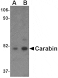 Western blot - Carabin Antibody from Signalway Antibody (24548) - Antibodies.com