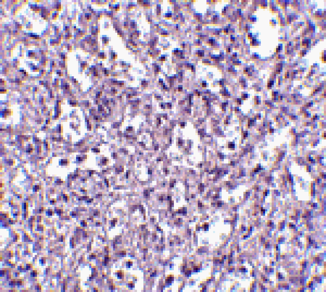 Immunohistochemistry - Carabin Antibody from Signalway Antibody (24548) - Antibodies.com